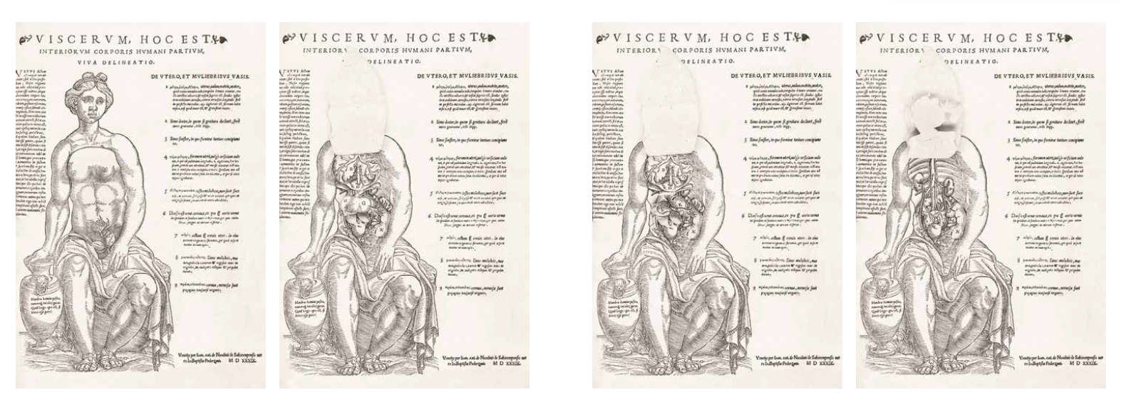 Giovanni Battista Pederzani, Viscerum, hoc est interiorum corporis humani partium, Venedig, Giovanni Antonio Nicolini da Sabbio (1539; Holzschnitte, farbige Details in verdünnter Tinte, 240 x 290 x 375 mm; London, The Wellcome Collection, Library, inv. EPB/D/7340.3) Giovanni Battista Pederzani, Viscerum, hoc est interiorum corporis humani partium, Venedig, Giovanni Antonio Nicolini da Sabbio (1539; Holzschnitte, farbige Details in verdünnter Tinte, 240 x 290 x 375 mm; London, The Wellcome Collection, Library, inv. EPB/D/7340.3)