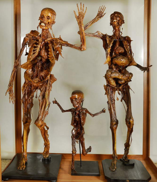 Le musée d'anatomie humaine de Pise Le musée d'anatomie humaine de Pise