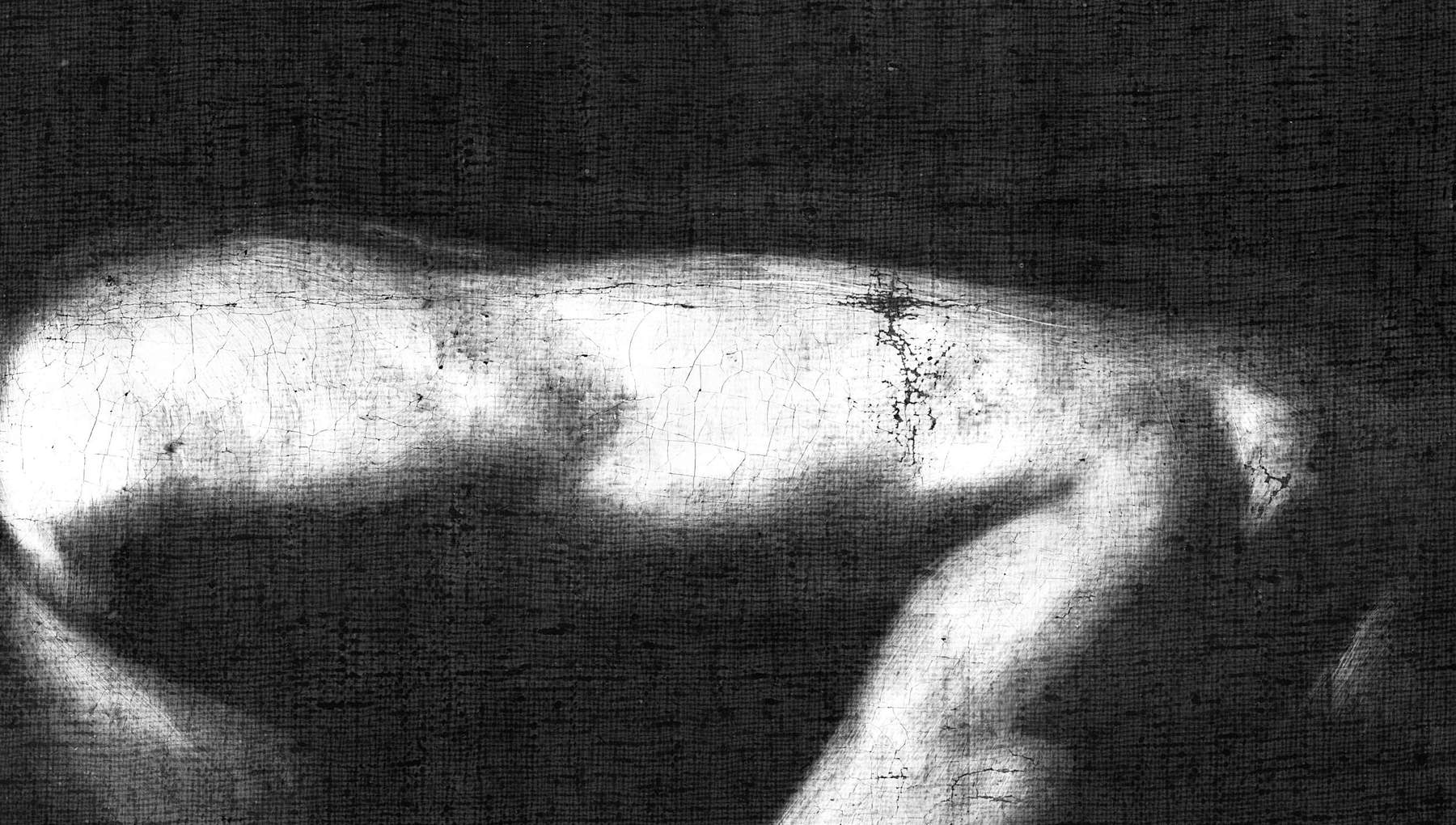 Die Röntgenaufnahme zeigt, wo der Arm ursprünglich positioniert war und später weiter nach unten verschoben wurde