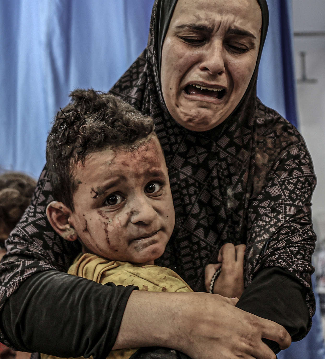 Ali Jadallah, A mother holds [her] injured child after an Israeli attack, as Israeli airstrikes continue on the twelfth day, at Al-Shifa Hospital in Gaza City (2023)